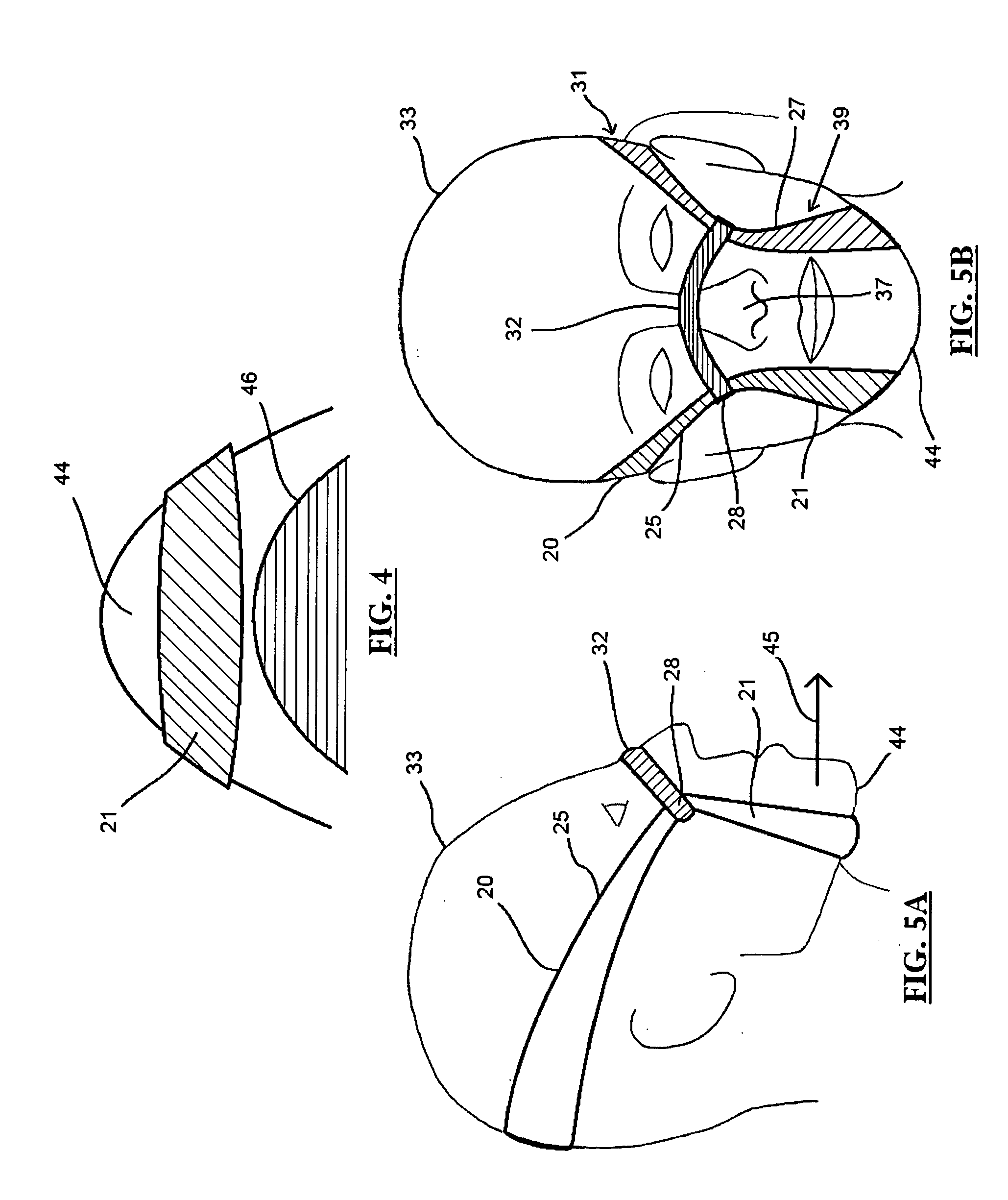 Sleep disorder relief device and method