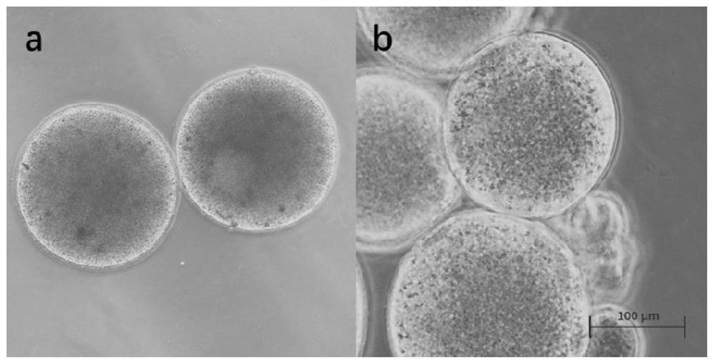 A controllable degradable embolic microsphere responsive to magnetic response hyperthermia and its preparation method and application