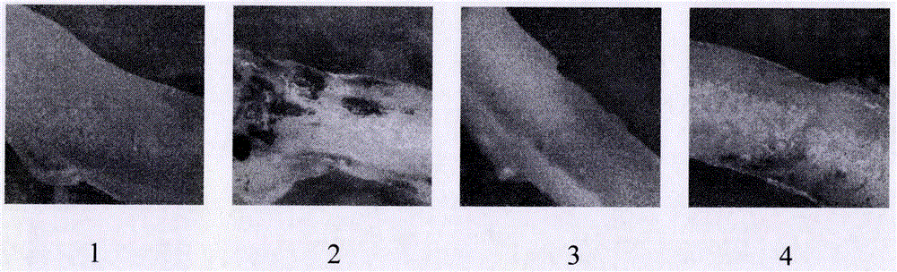 Medicinal composition for treating arteriosclerosis and application of medicinal composition