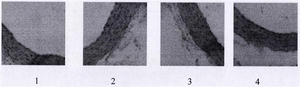 Medicinal composition for treating arteriosclerosis and application of medicinal composition