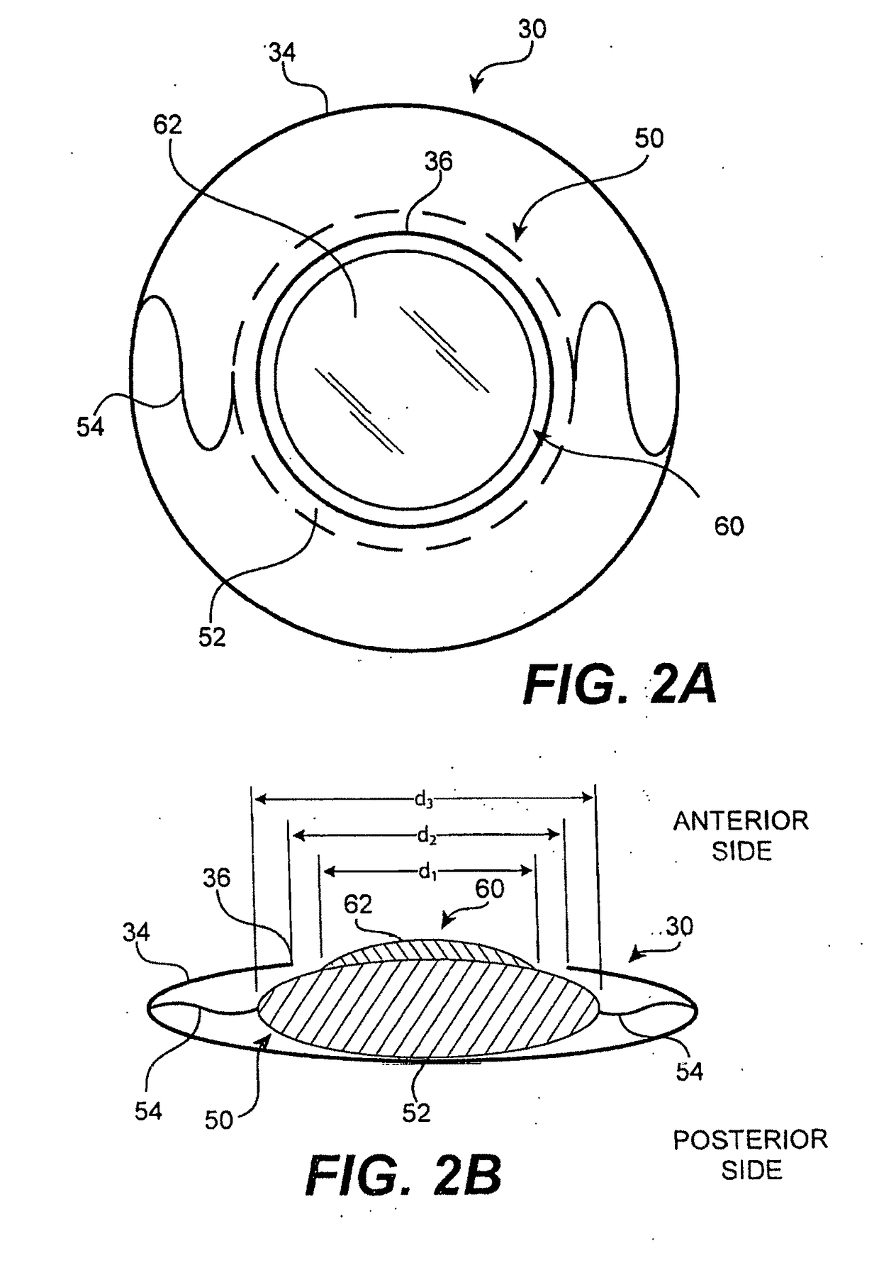 Modular intraocular lens designs, tools and methods