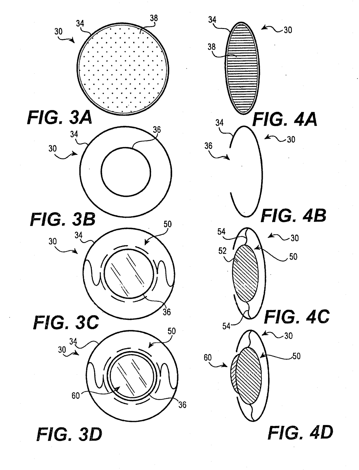 Modular intraocular lens designs, tools and methods