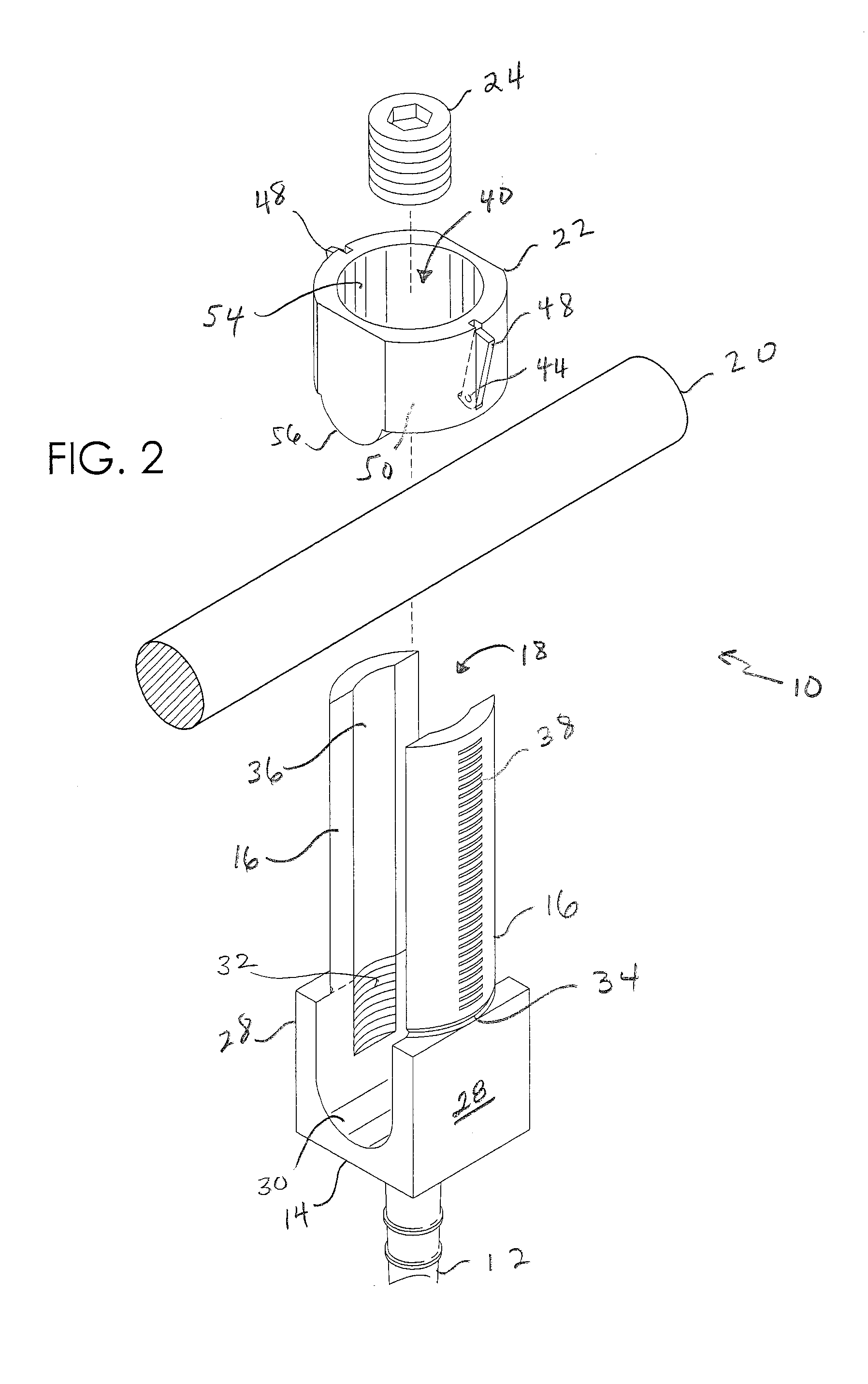 Screw and rod fixation system