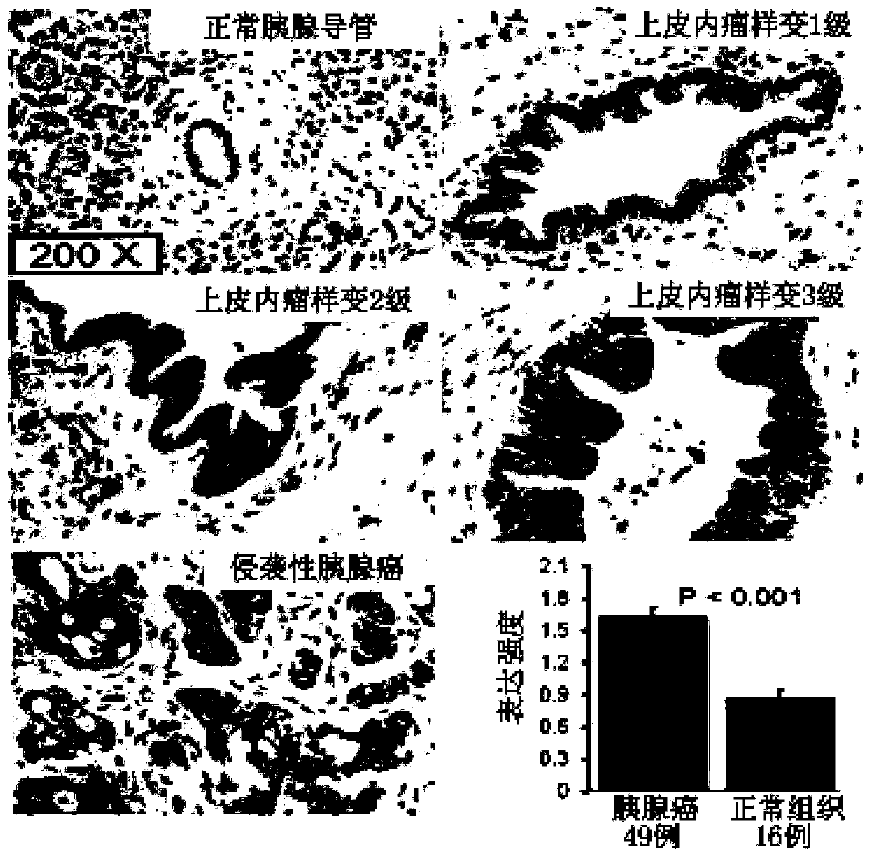 Application of p38 gamma in preparation of pancreatic cancer prognosis diagnostic reagent