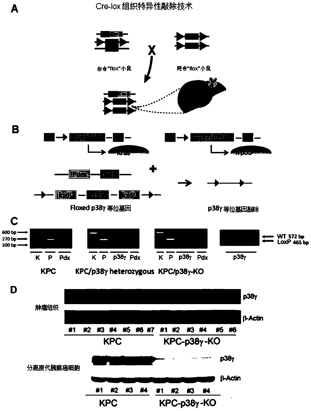 Application of p38 gamma in preparation of pancreatic cancer prognosis diagnostic reagent