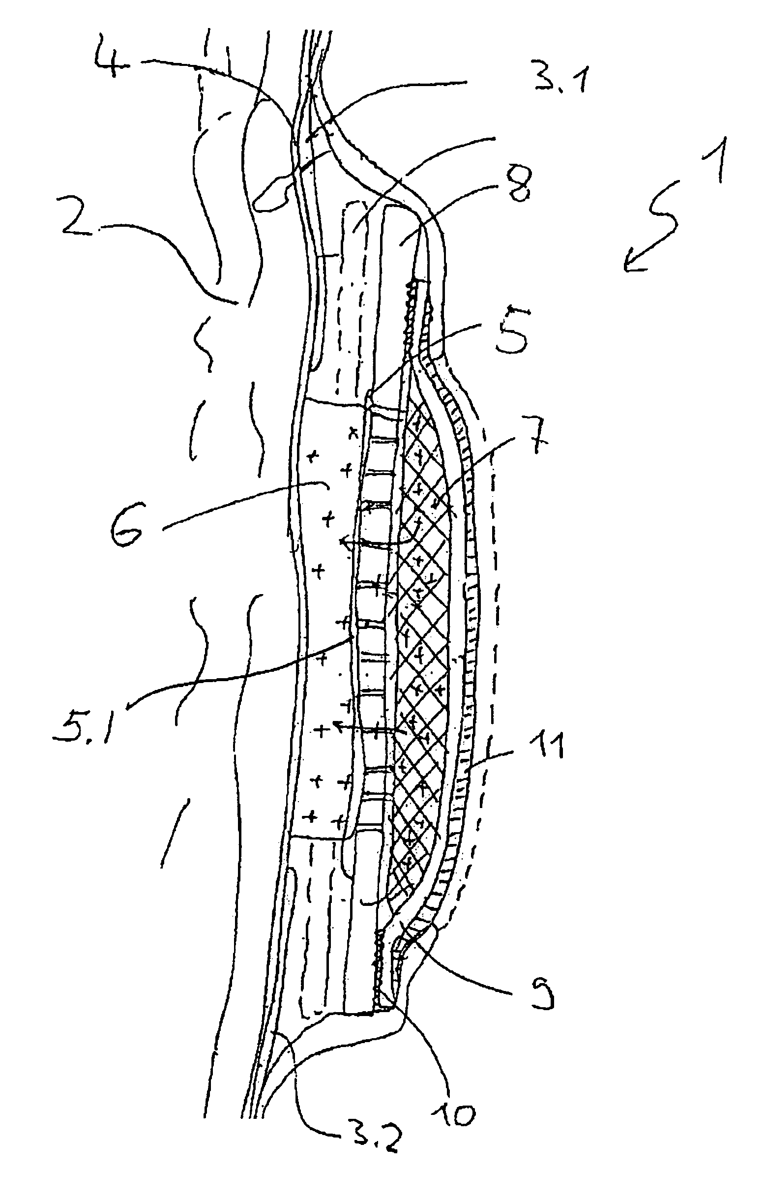 Measuring electrode system