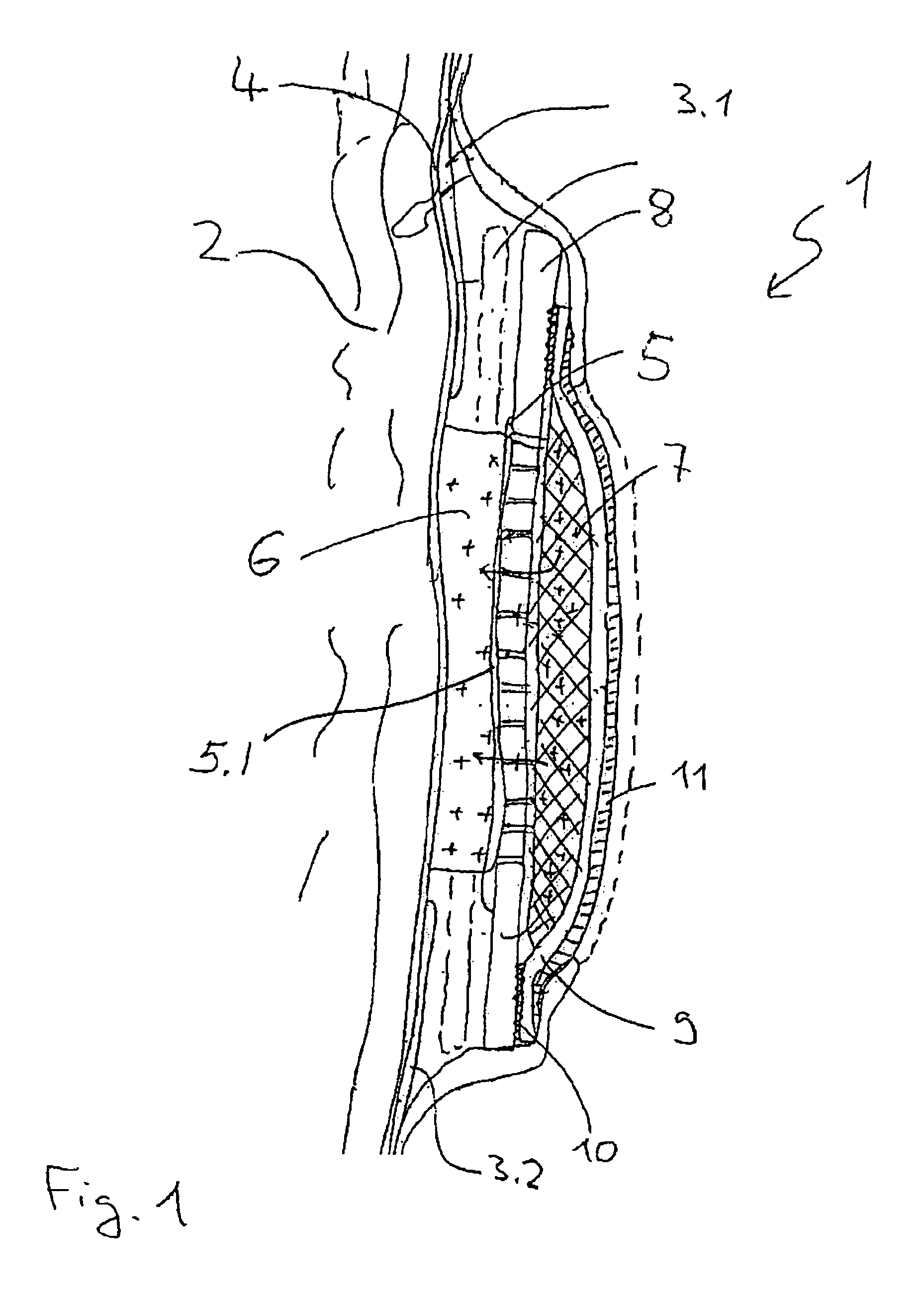 Measuring electrode system