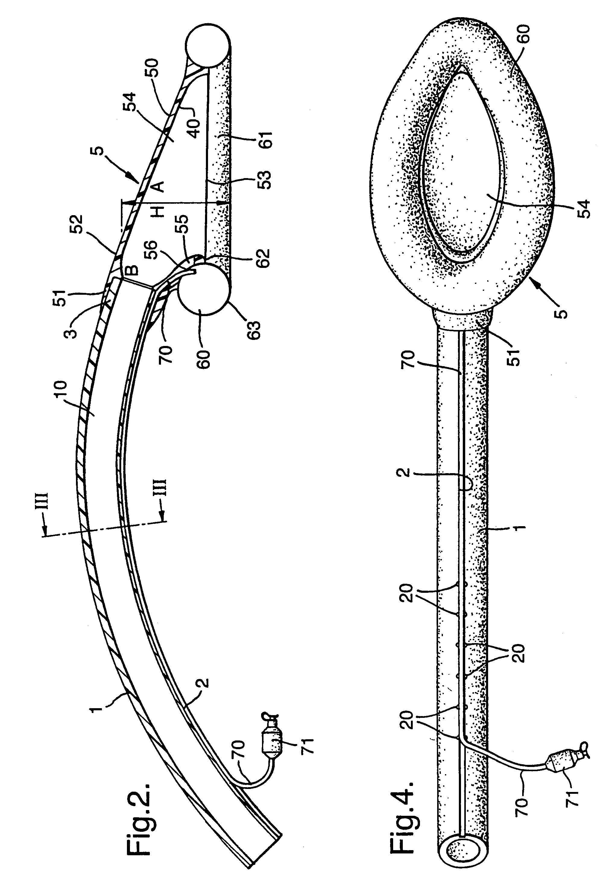 Laryngeal mask airway