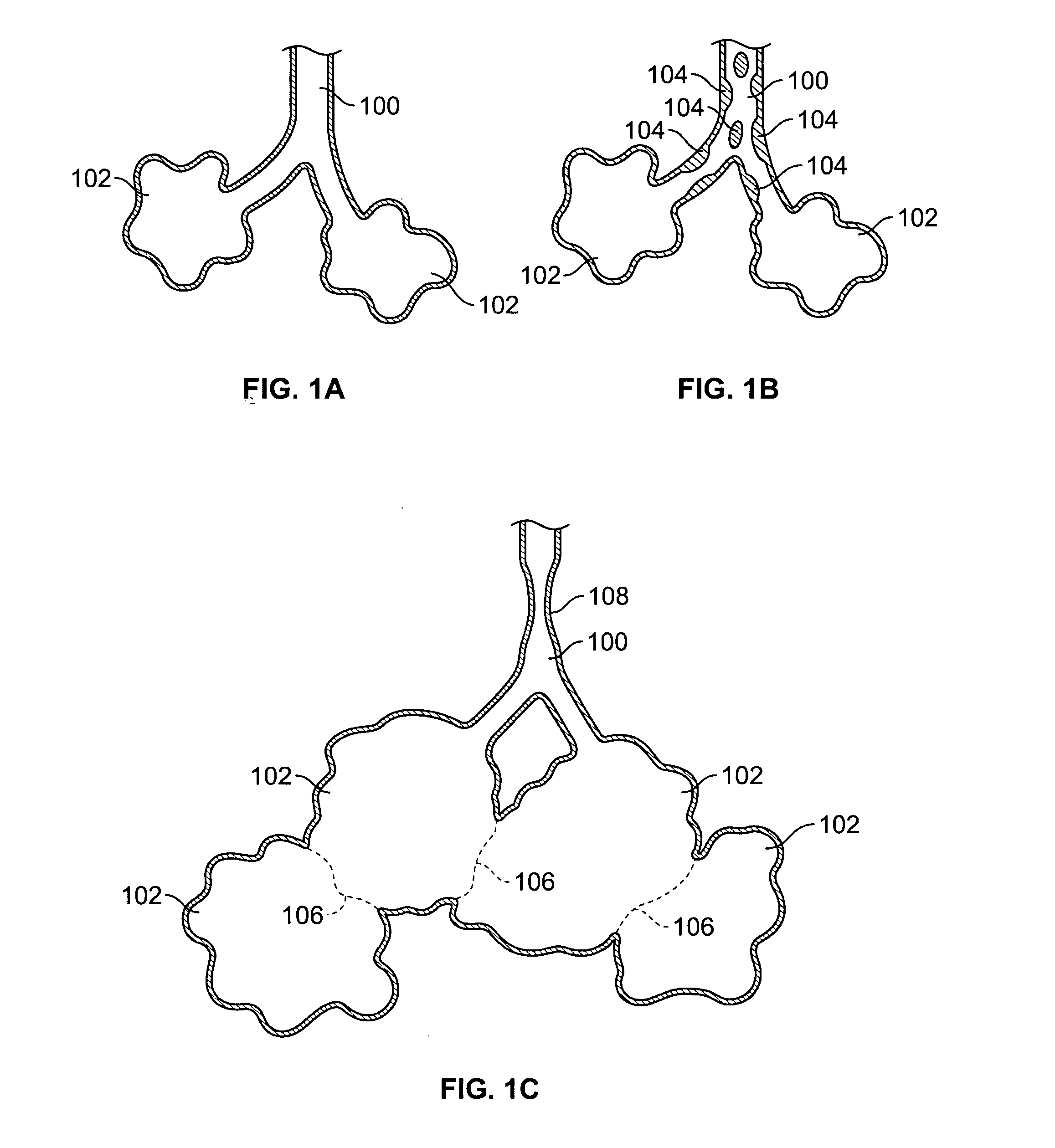 Devices for maintaining patency of surgically created channels in tissue