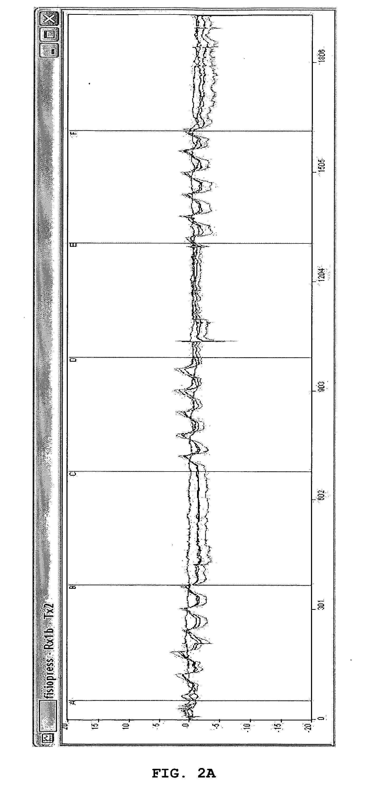 Device for pneumatic treatment of an inferior limb having peripheral arteriopathy problems