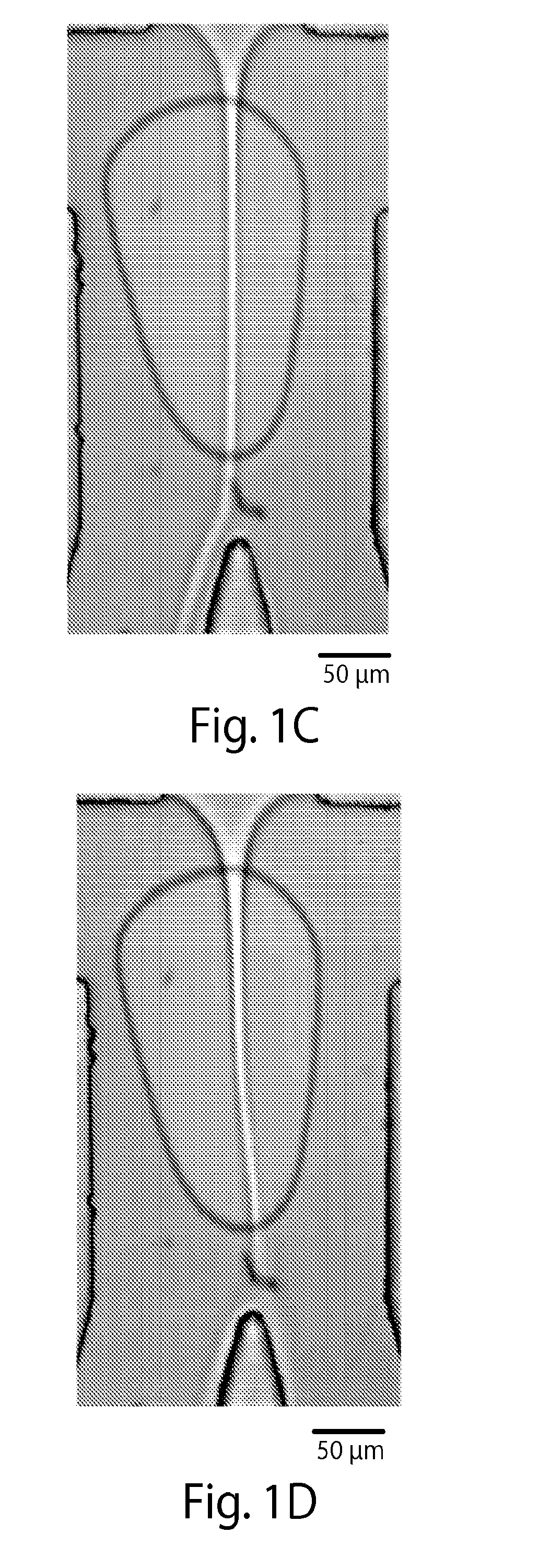 Acoustic waves in microfluidics