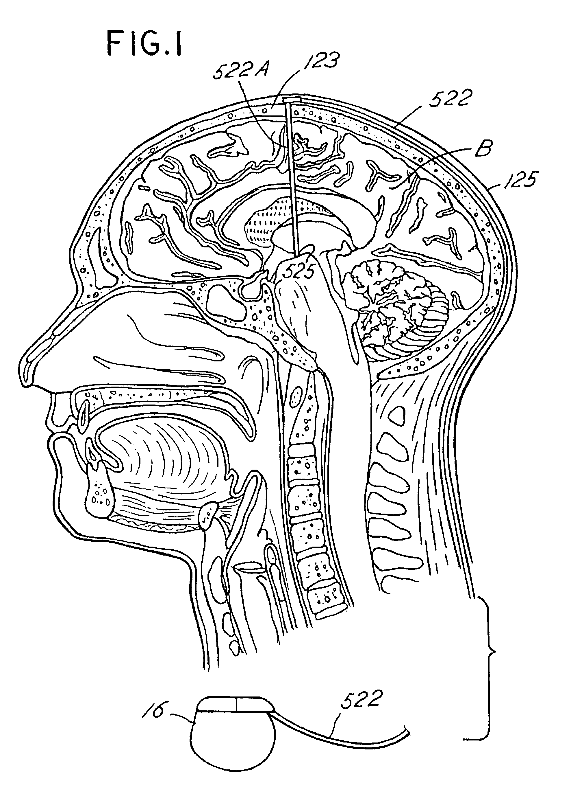 Inducing neurogenesis within a human brain