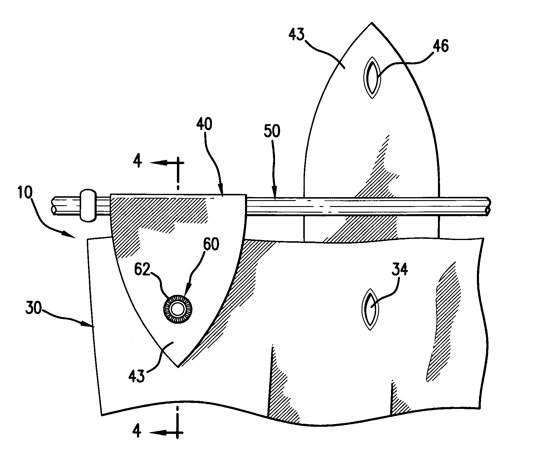 Interchangeable window treatment system