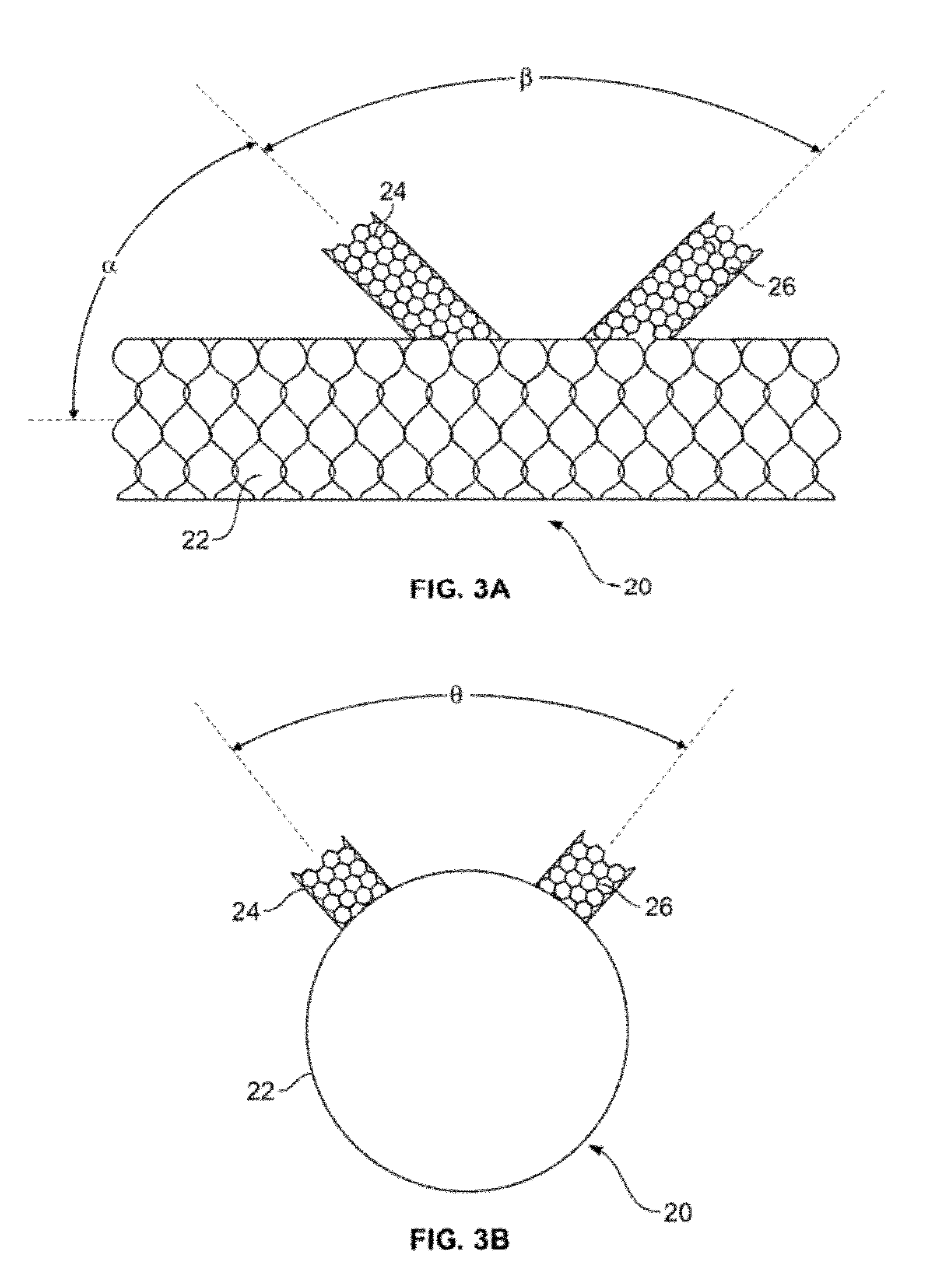 Vascular implants and methods