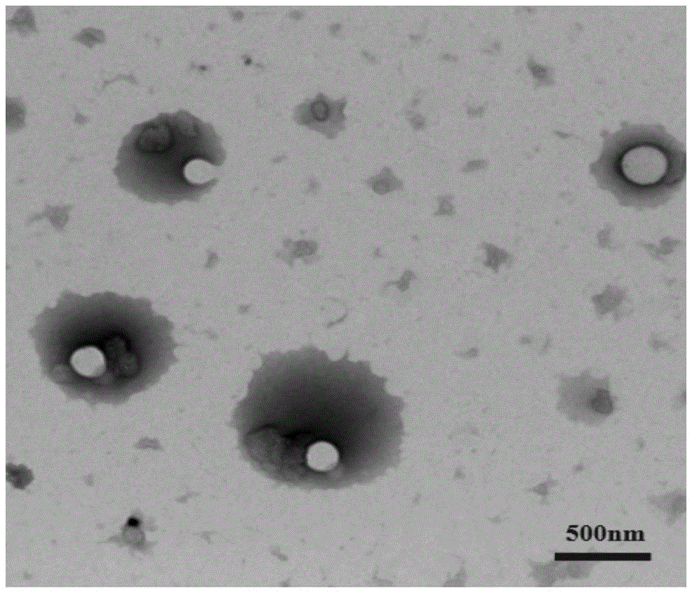 High-polymer vesicle containing AIE (aggregation-induced emission) molecules as well as preparation method and application of high-polymer vesicle