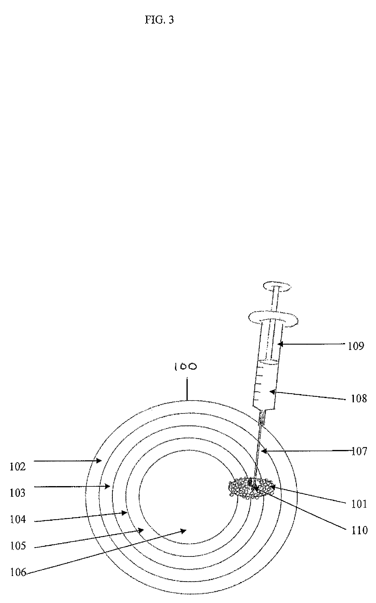 Composition and method of using medicament for treatment of cancers and tumors