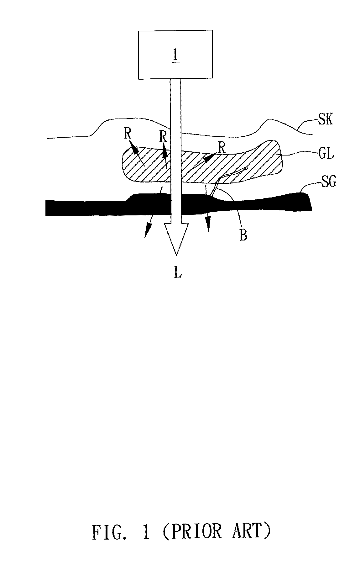 Optical blood glucose detecting apparatus and operating method thereof