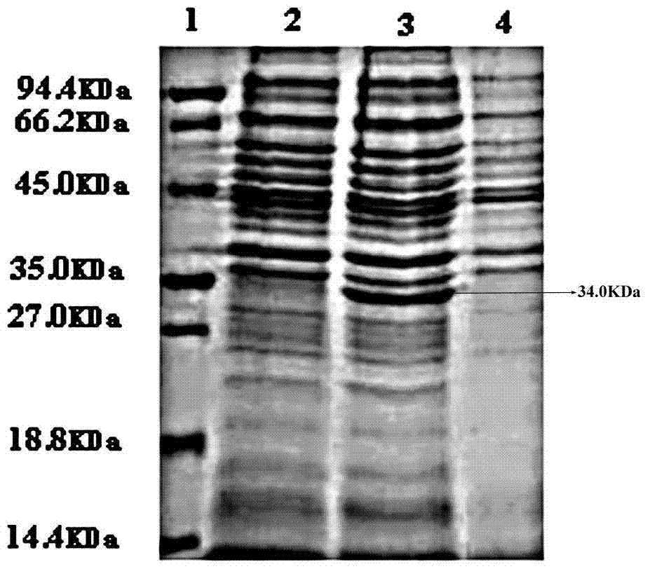 Catalytically active human urate oxidase