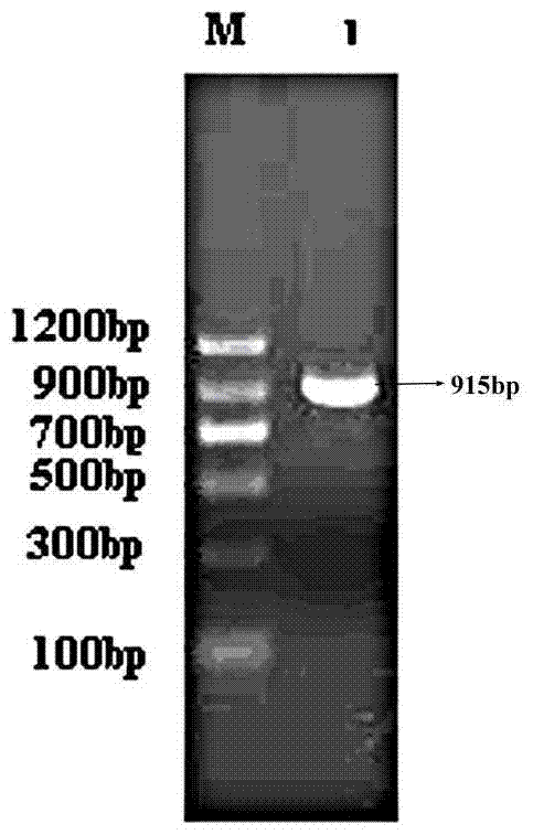 Catalytically active human urate oxidase