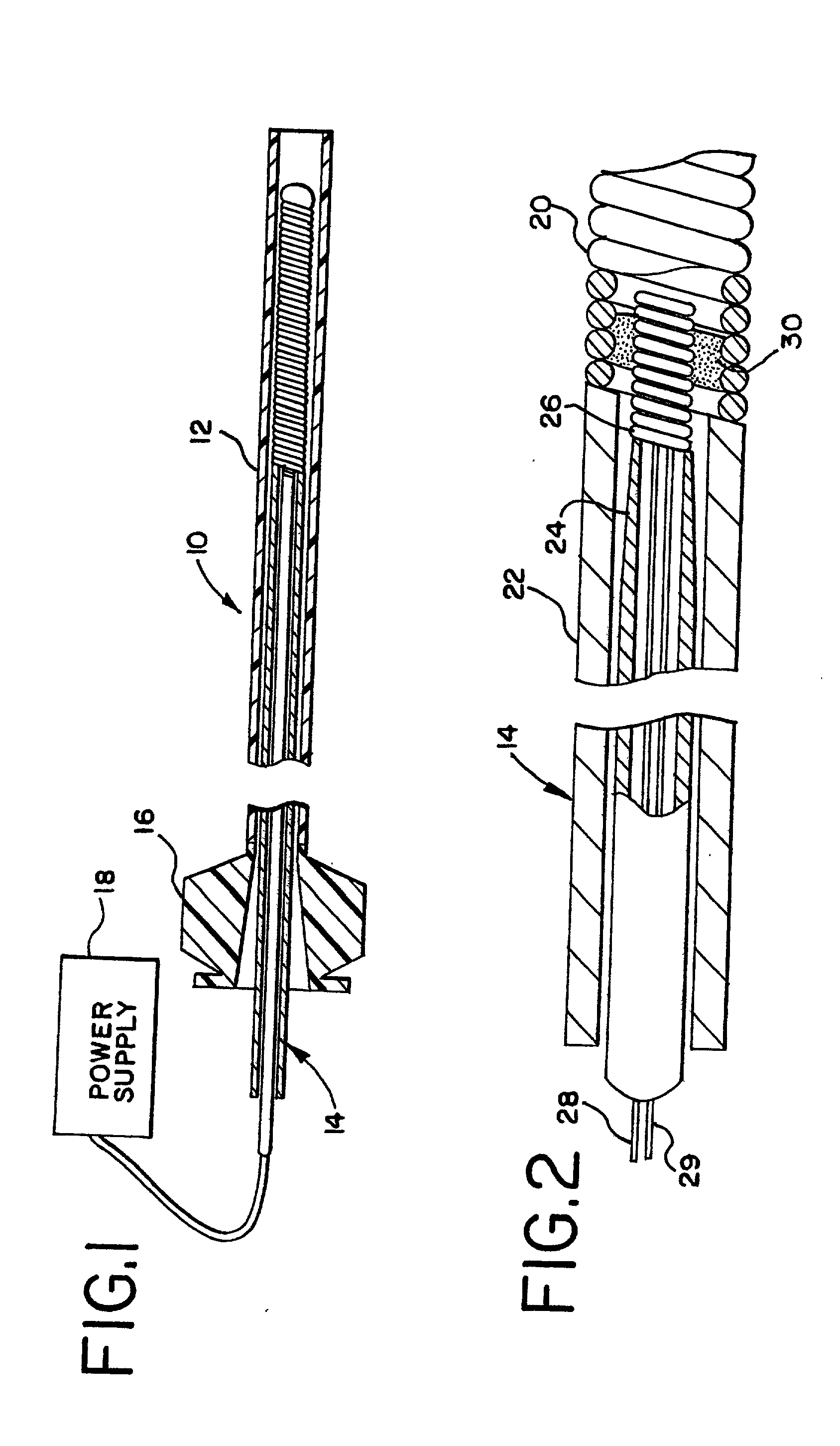 Heated vascular occlusion coil deployment system