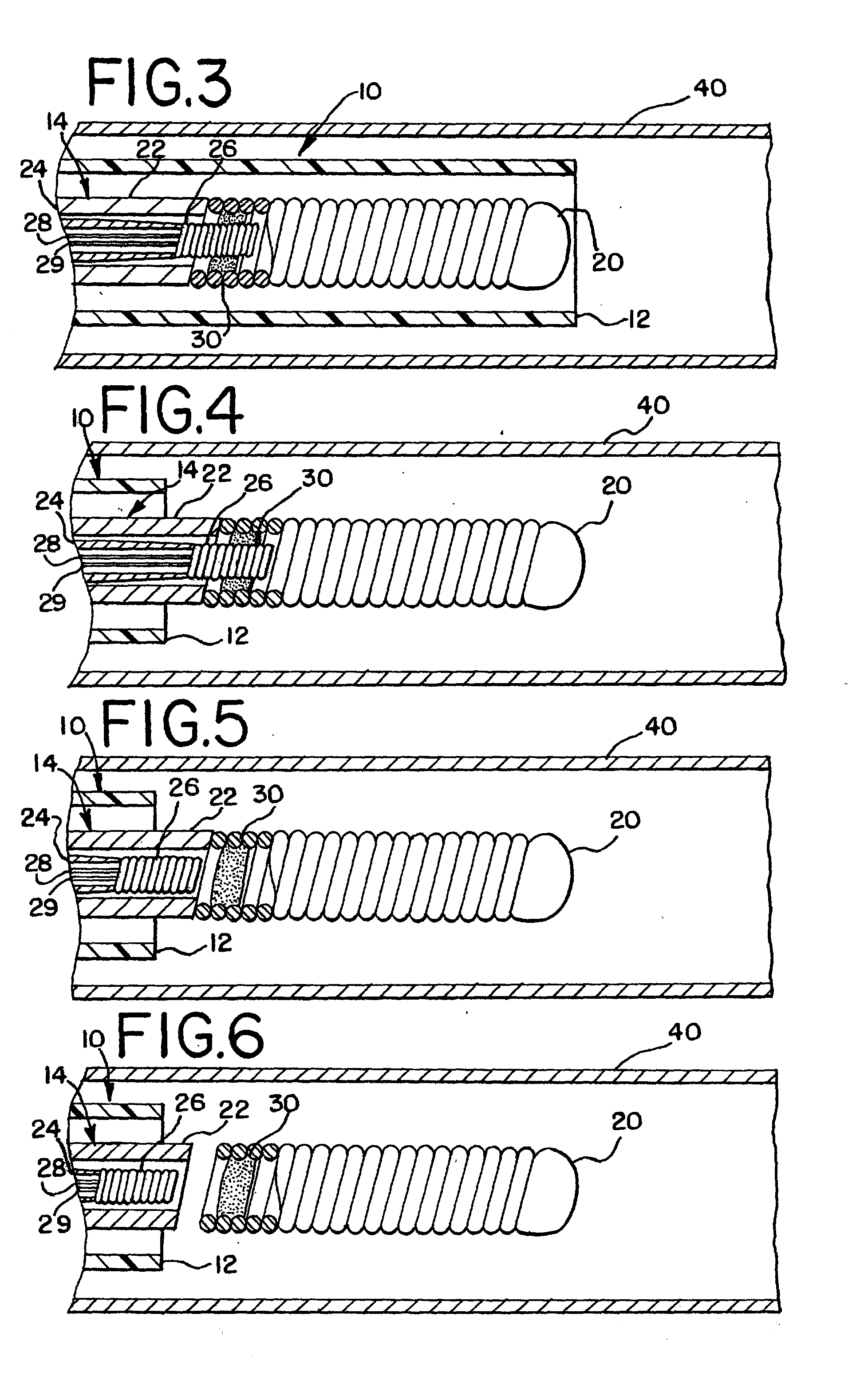 Heated vascular occlusion coil deployment system