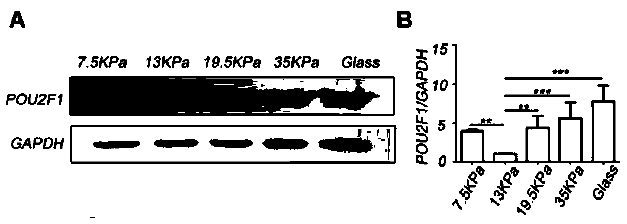 Application of POU2F1 gene expression inhibitor in preparation of drugs treating tissue fibrosis diseases