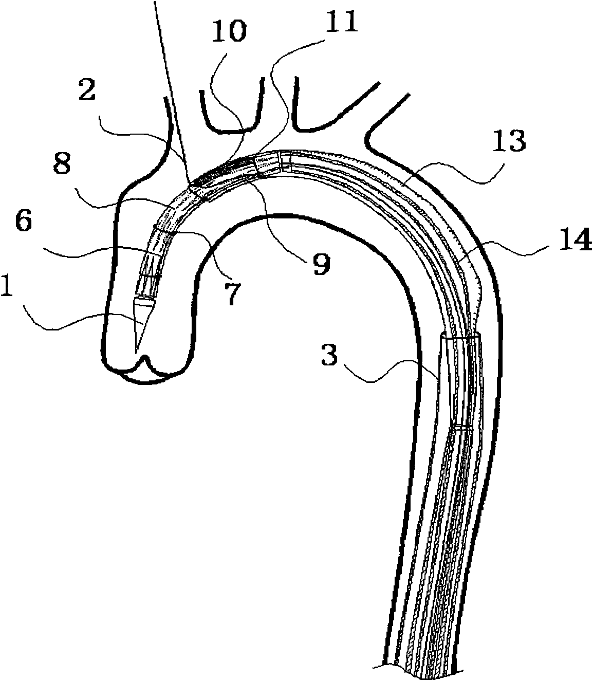 Branched membrane-covered support conveying system and conveying method thereof