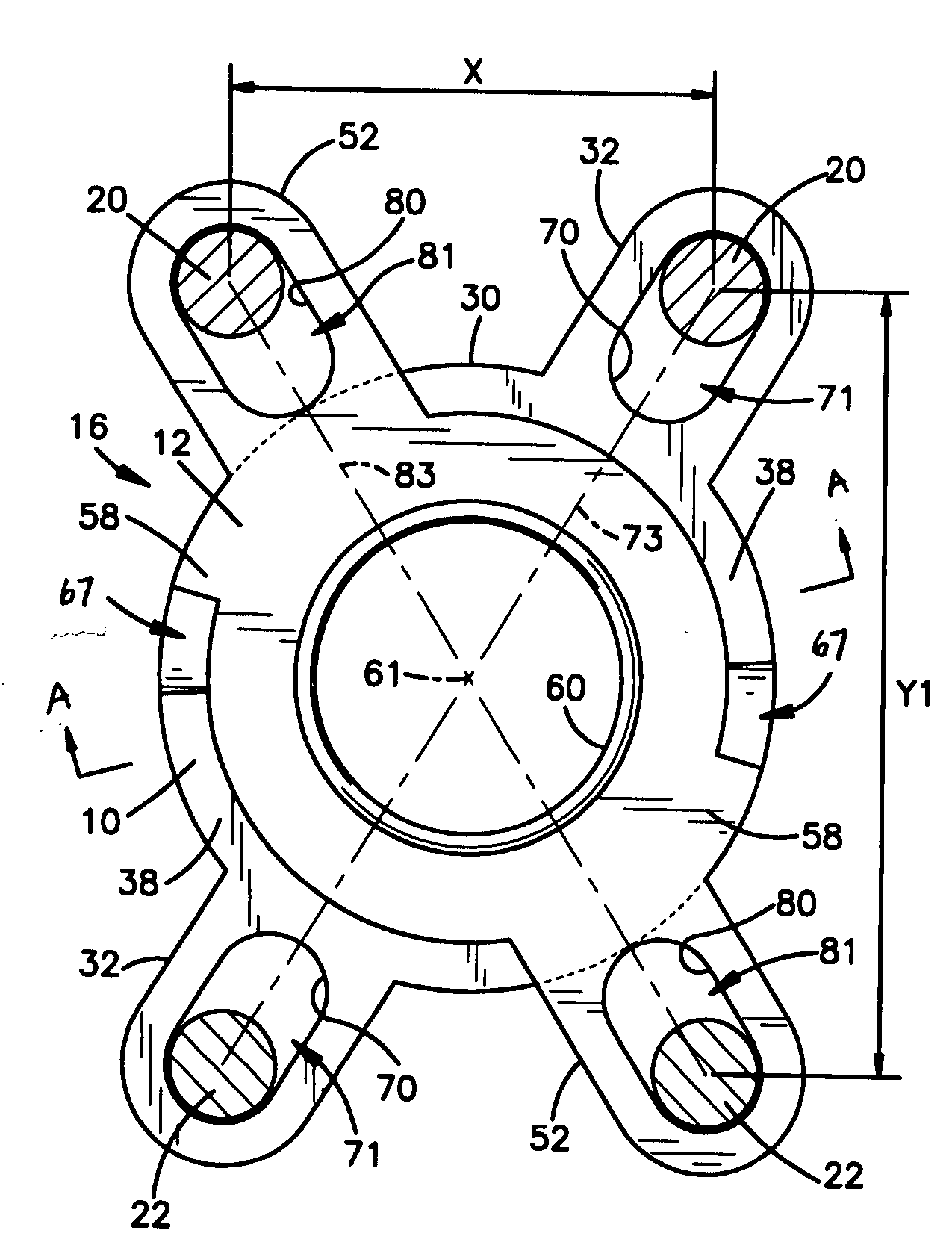 Translational scissor plate fixation system