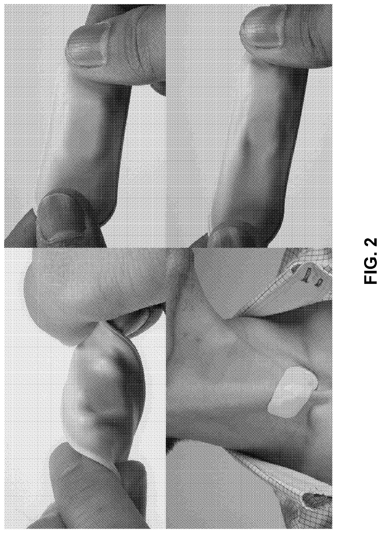 Wireless medical sensors and methods