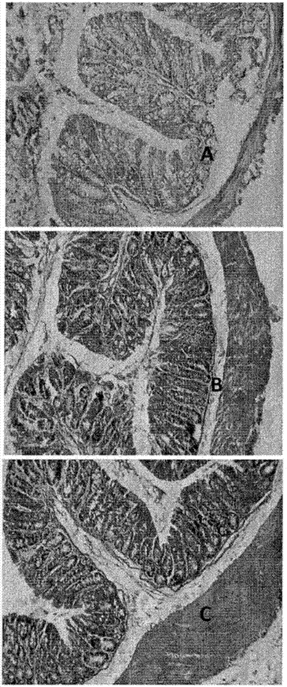 Anti-CXCL9, anti-CXCL10, anti-CXCL11, anti-CXCL13, anti-CXCR3 and anti-CXCR5 reagents used for inflammatory diseases