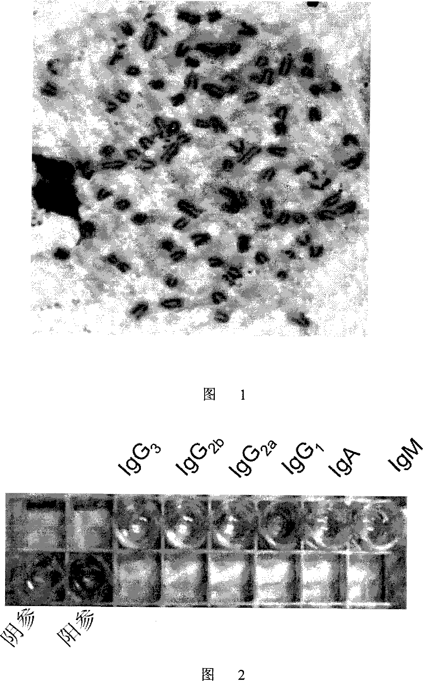 LRP16 monoclonal antibody hybrid oncocyte strain and uses thereof