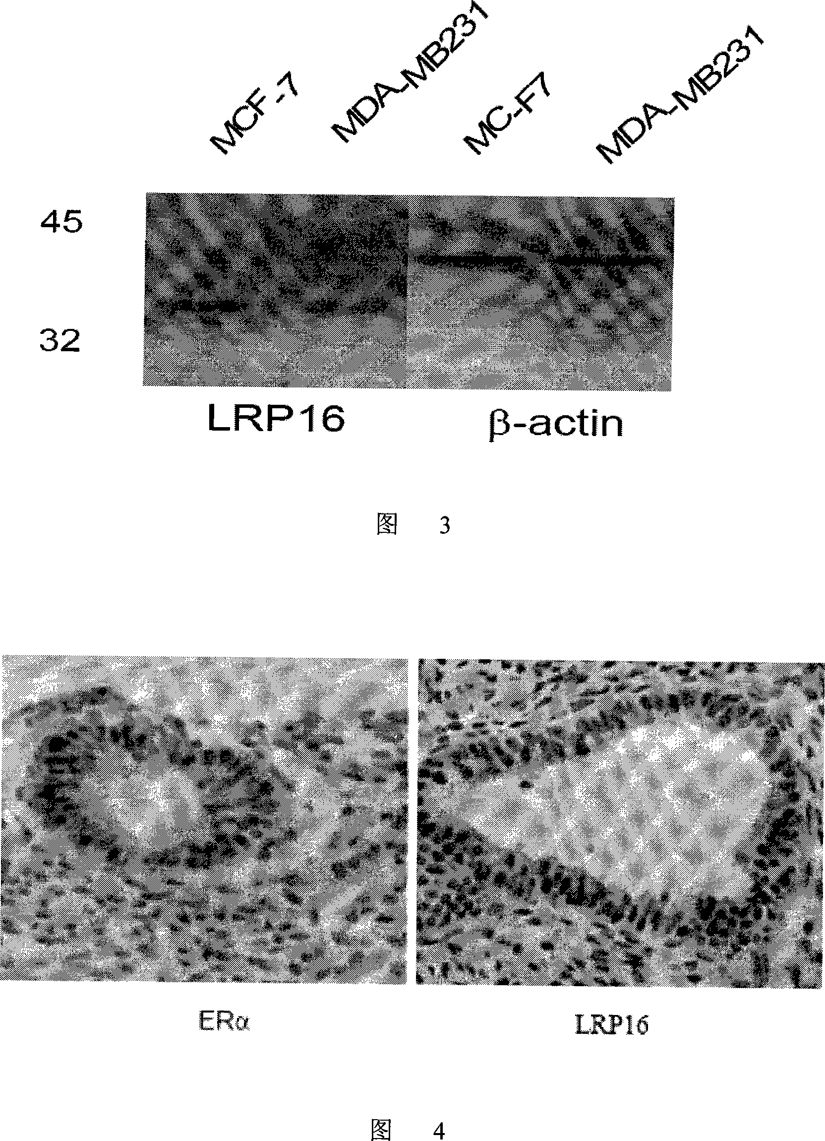 LRP16 monoclonal antibody hybrid oncocyte strain and uses thereof