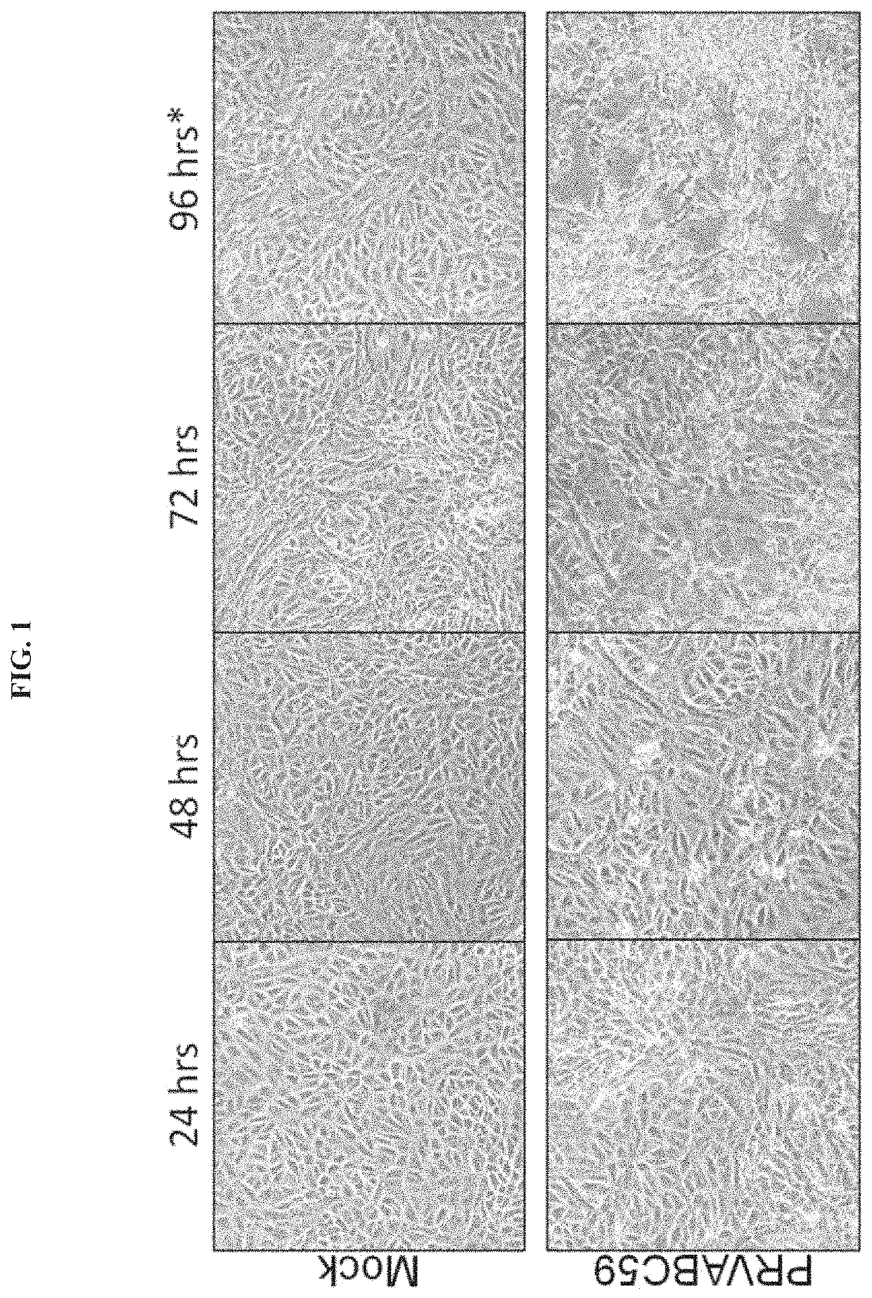 Zika Vaccines and Immunogenic Compositions, and Methods of Using the Same