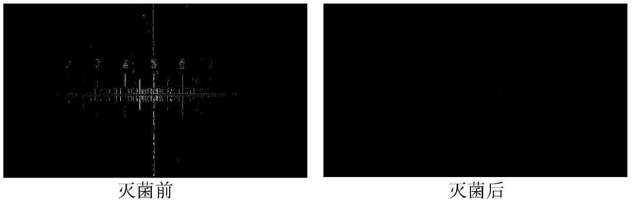 A kind of suspension containing dexamethasone and preparation method thereof