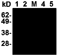 Type a foot-and-mouth disease genetic engineering compound epitope protein and vaccine