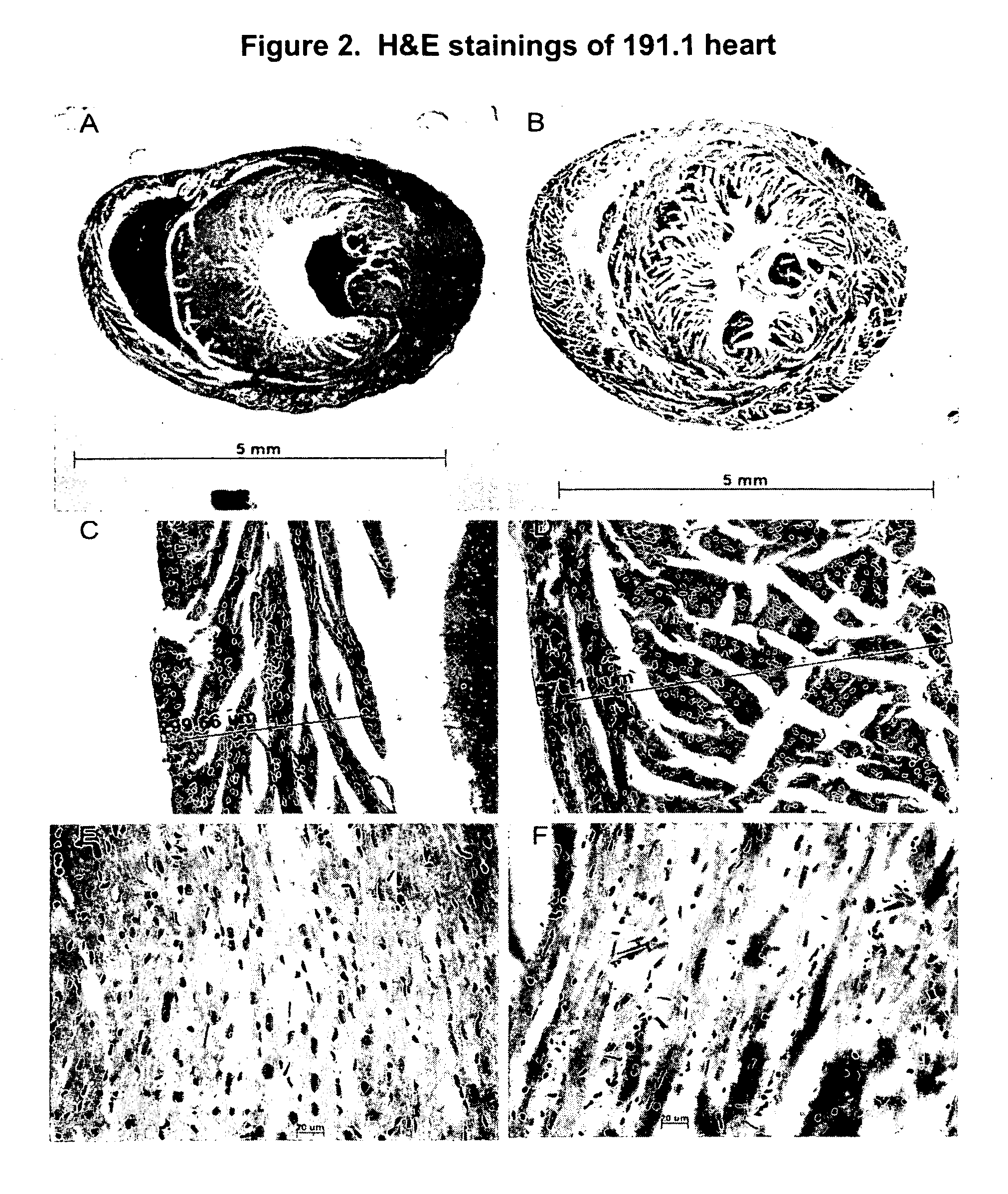 Procollagen IIA deficient mice