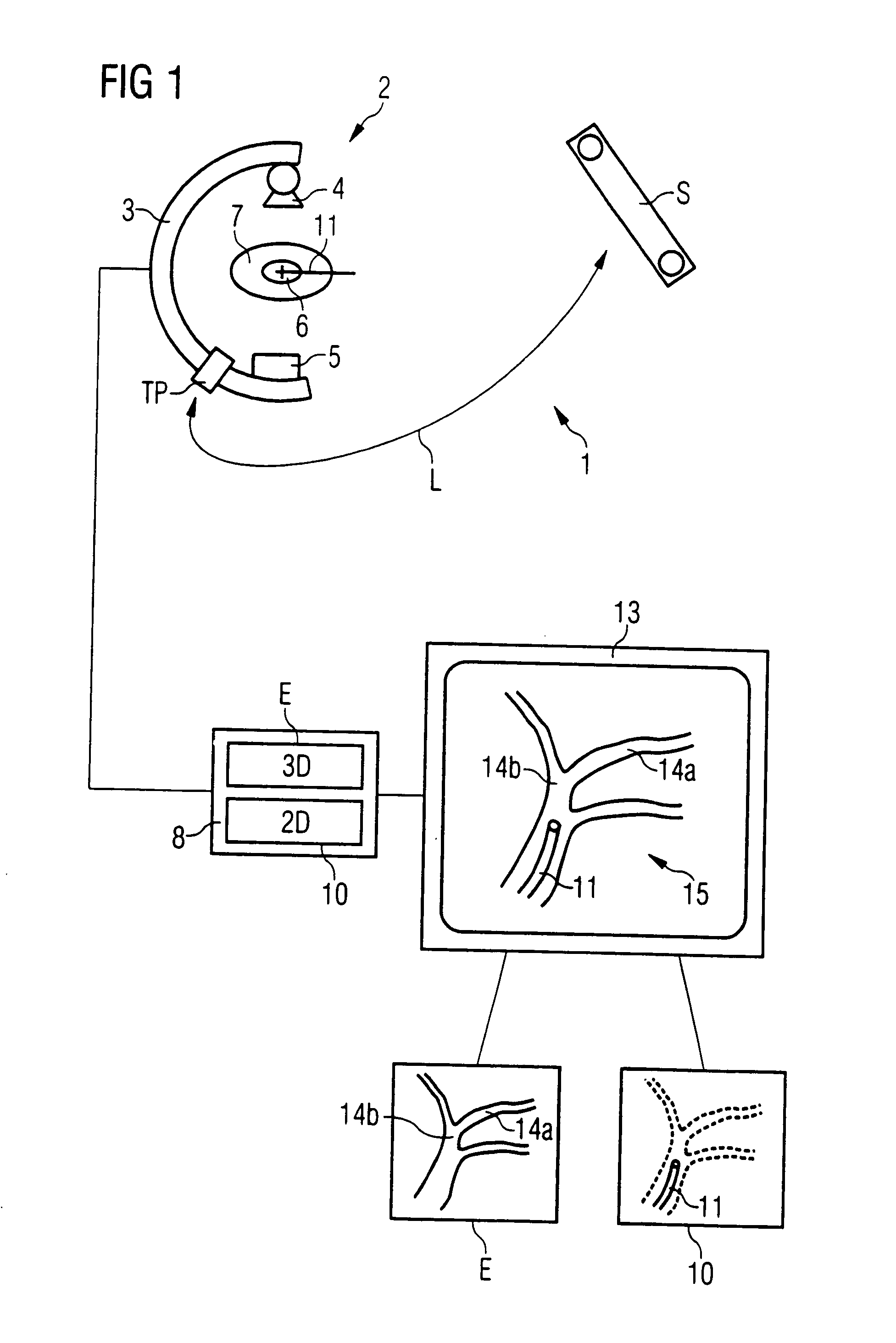 Method for automatically merging a 2D fluoroscopic C-arm image with a preoperative 3D image with one-time use of navigation markers