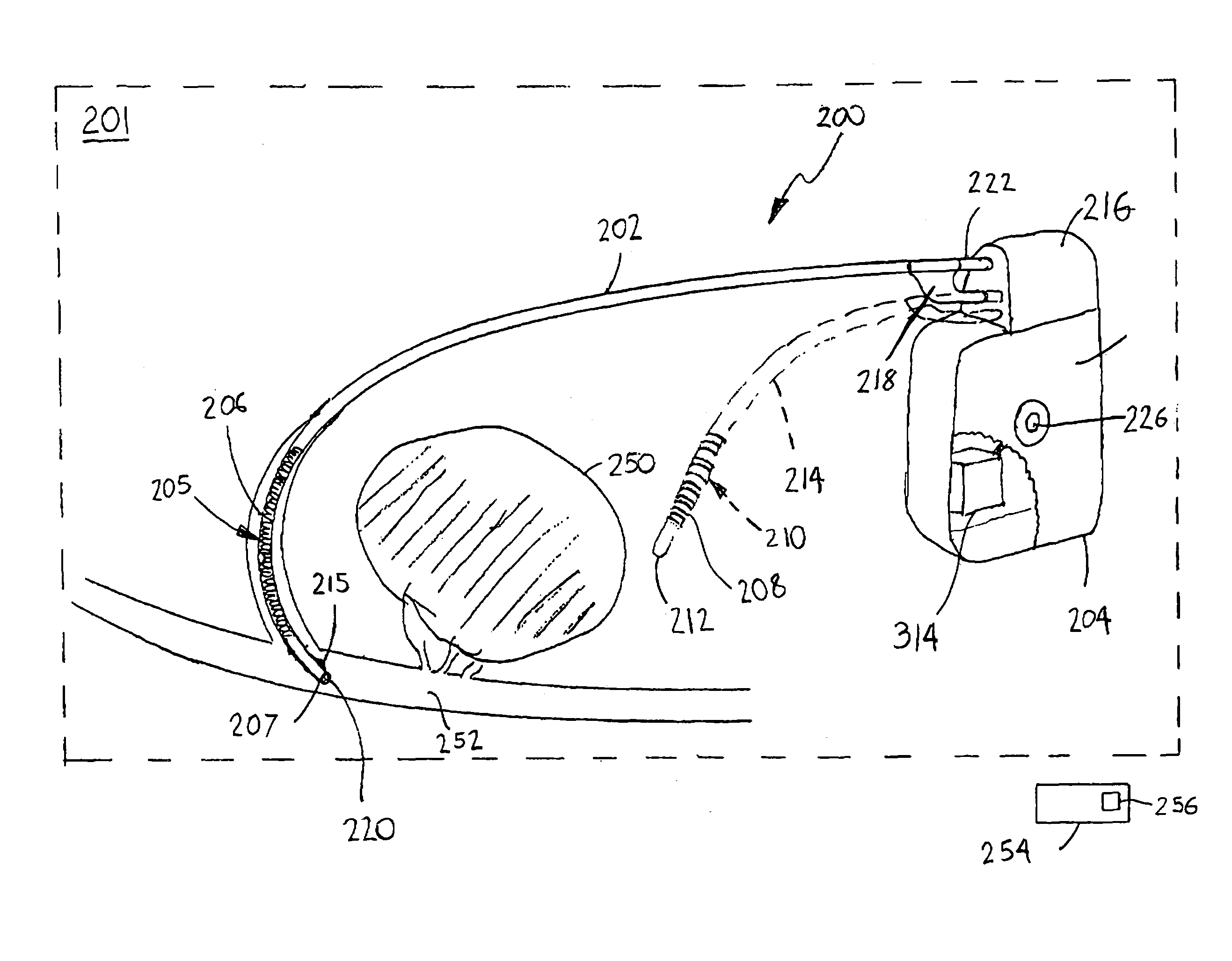 Implantable electroporation therapy device and method for using same