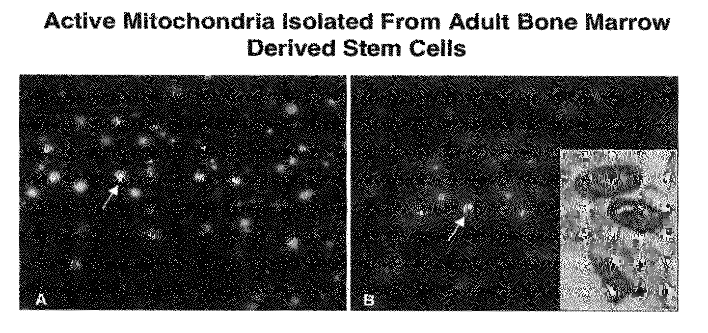 Methods and compositions for mitochondrial replacement therapy