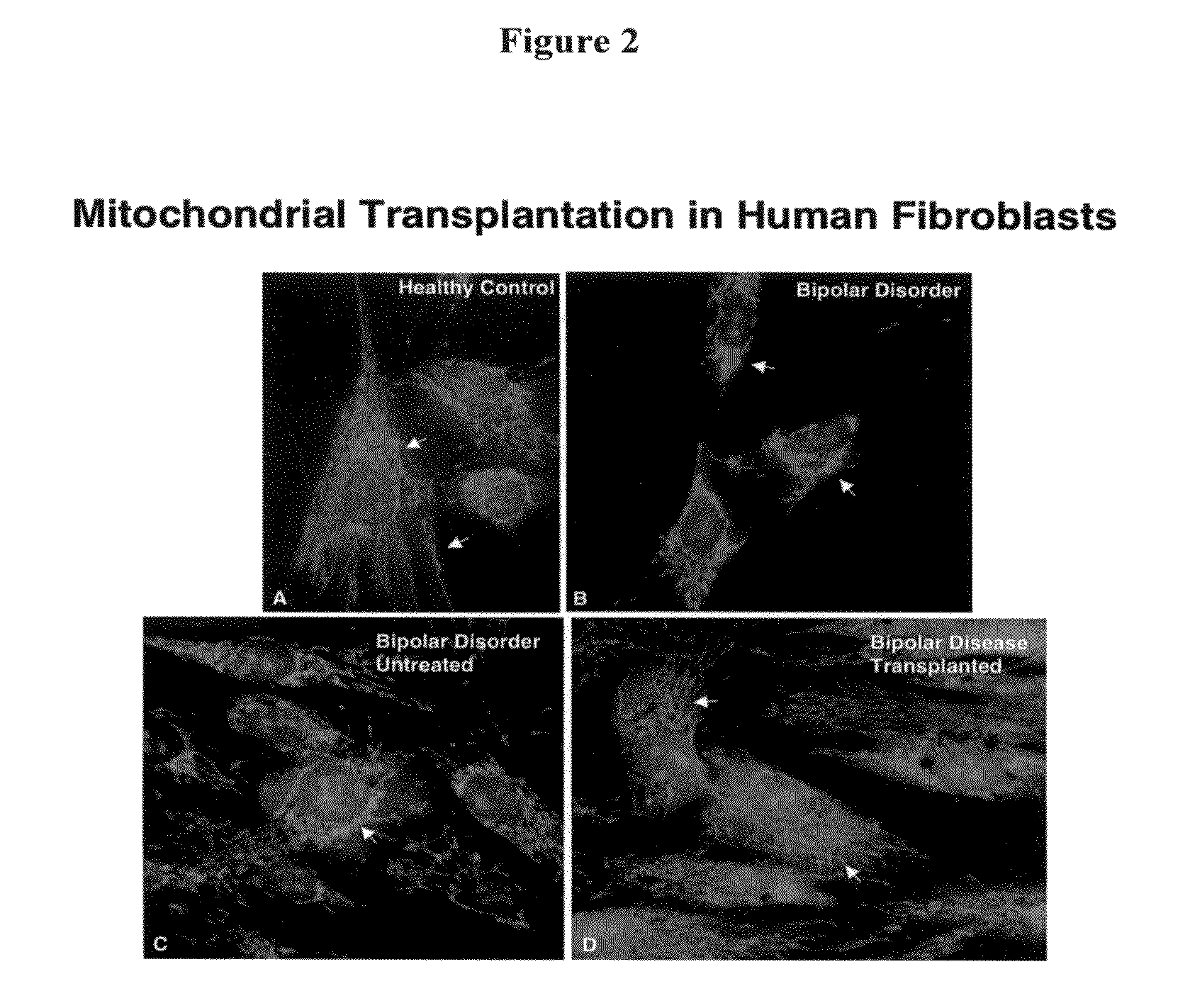 Methods and compositions for mitochondrial replacement therapy