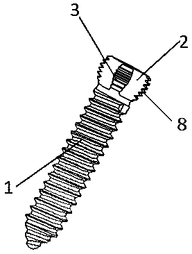 Steel plate screw system with universal locking function