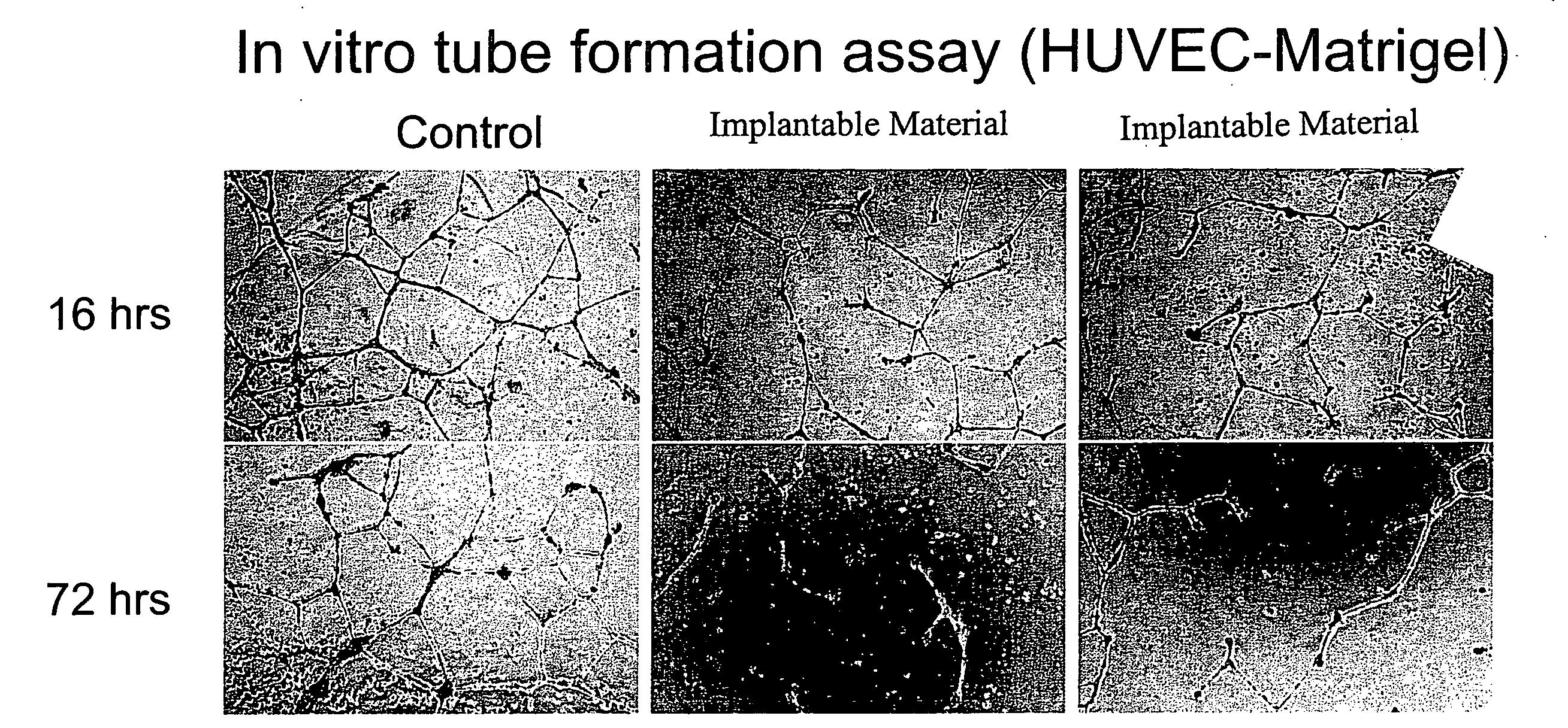 Materials and Methods for Treating and Managing Angiogenesis-Mediated Diseases