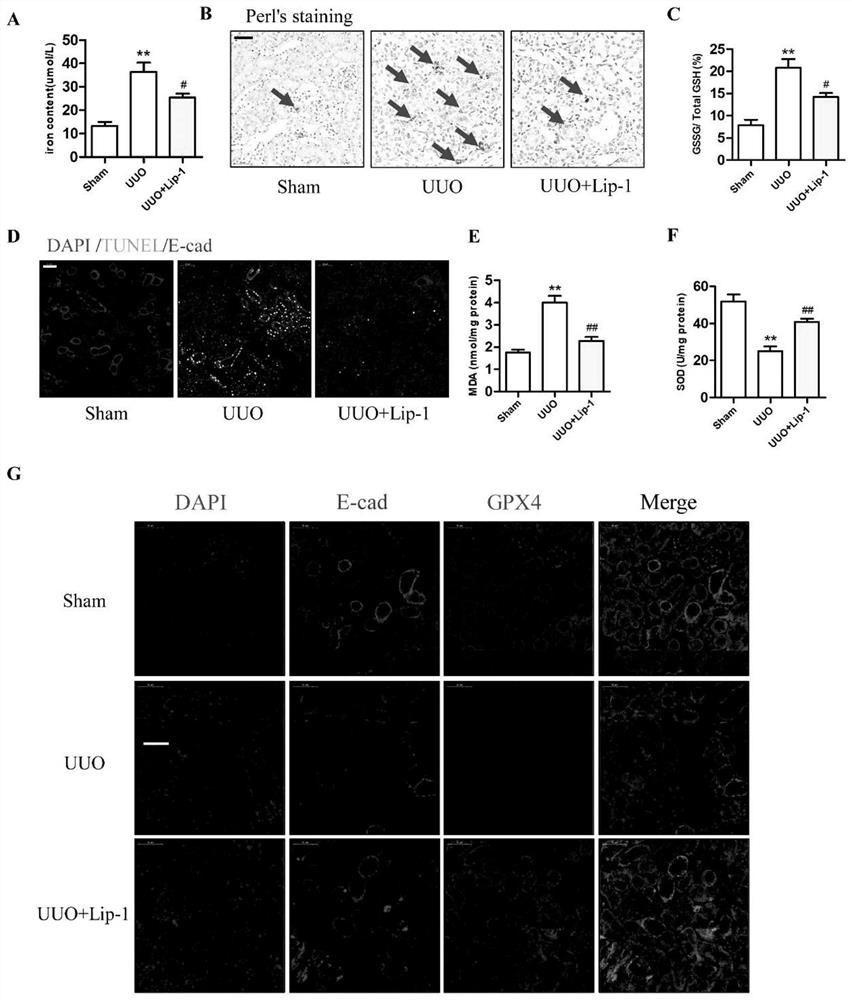 Application of ferroptosis inhibitor Liproxstatin-1 in preparation of drugs for relieving renal fibrosis