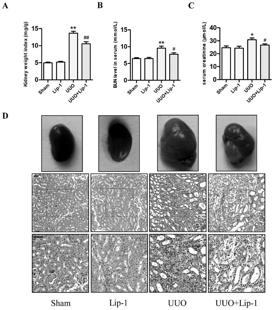 Application of ferroptosis inhibitor Liproxstatin-1 in preparation of drugs for relieving renal fibrosis