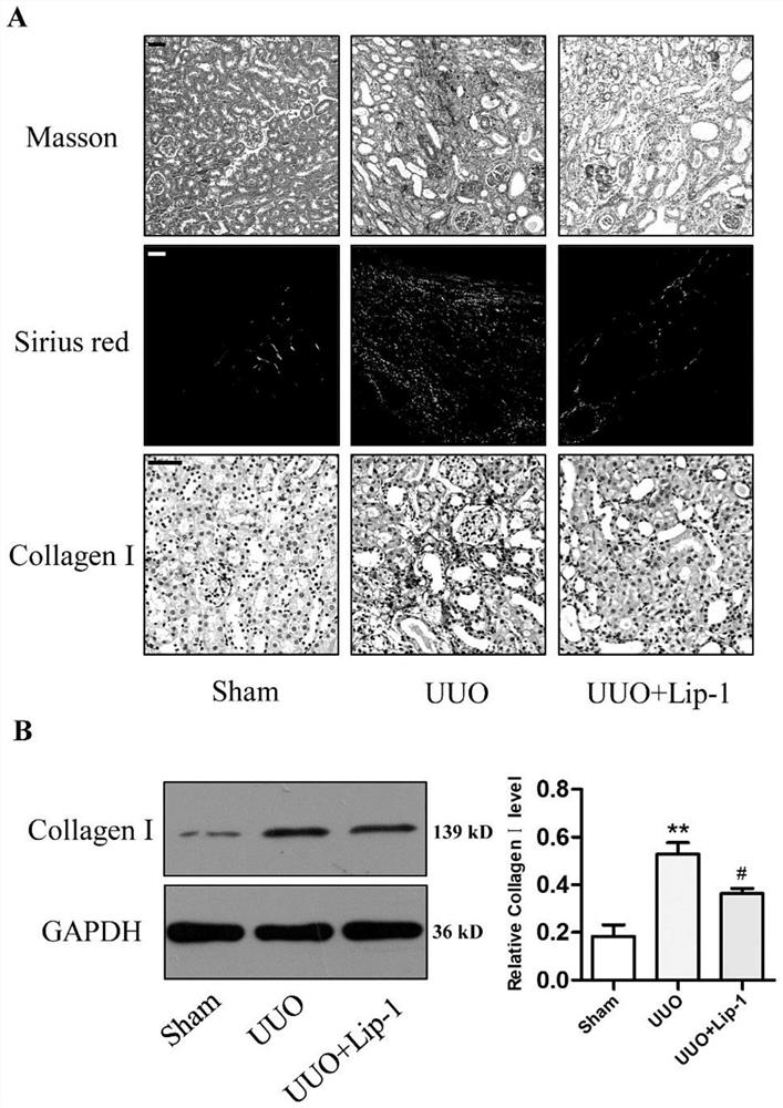 Application of ferroptosis inhibitor Liproxstatin-1 in preparation of drugs for relieving renal fibrosis