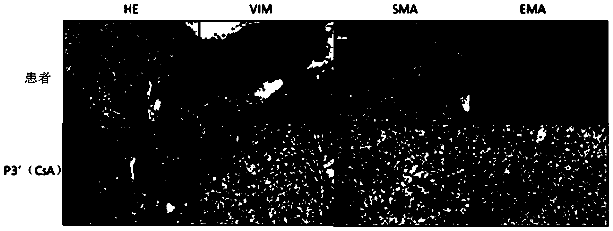 Method for constructing immune healthy synovial sarcoma xenograft mouse model