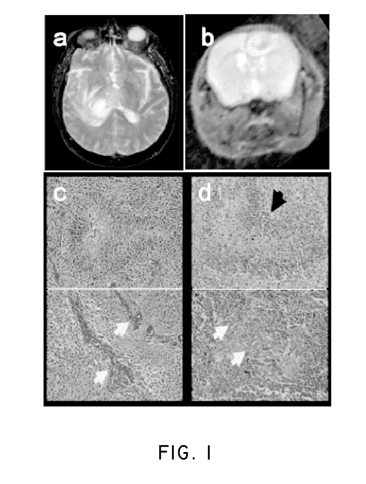 Method of treating cancer associated with a ras mutation