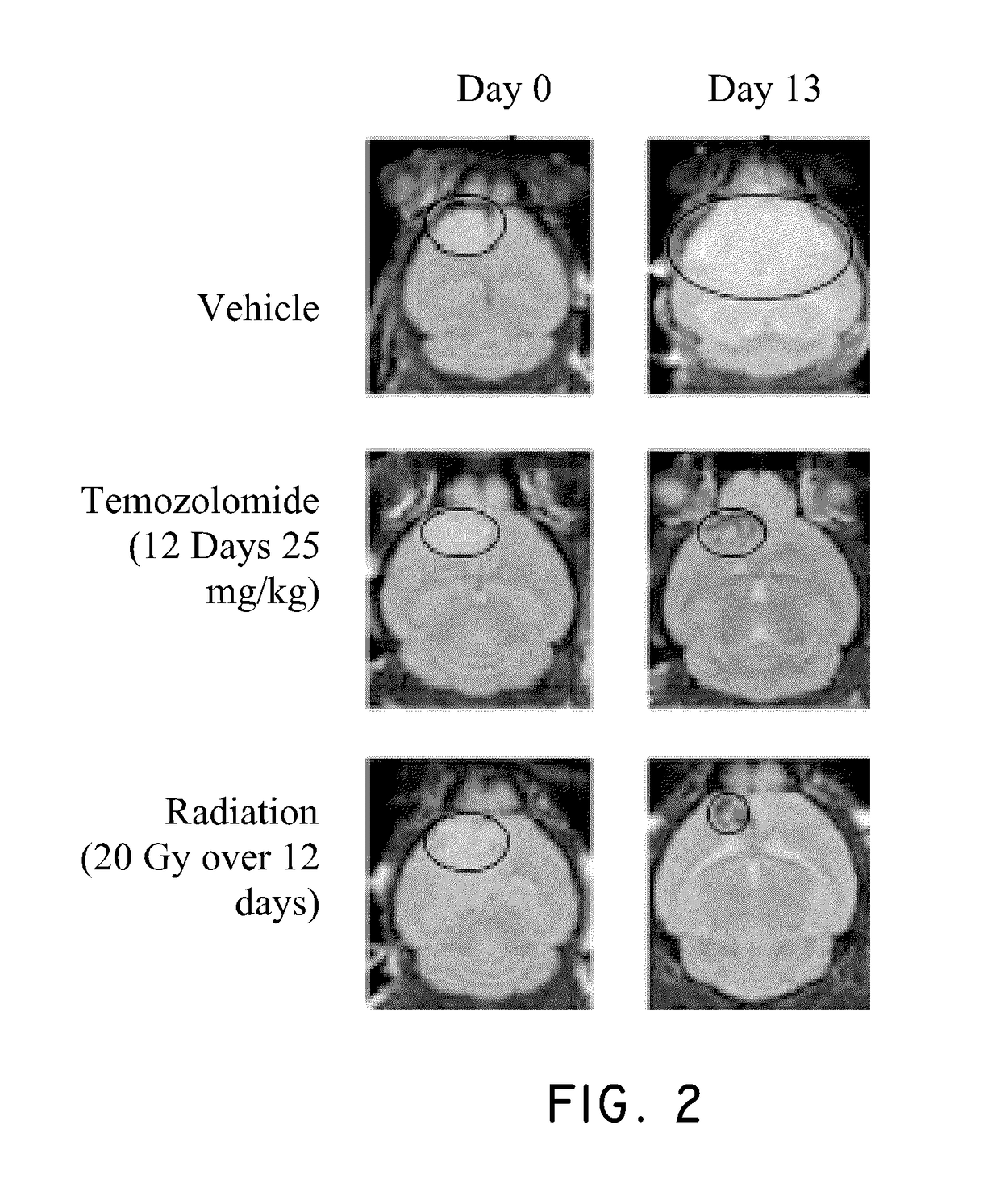 Method of treating cancer associated with a ras mutation