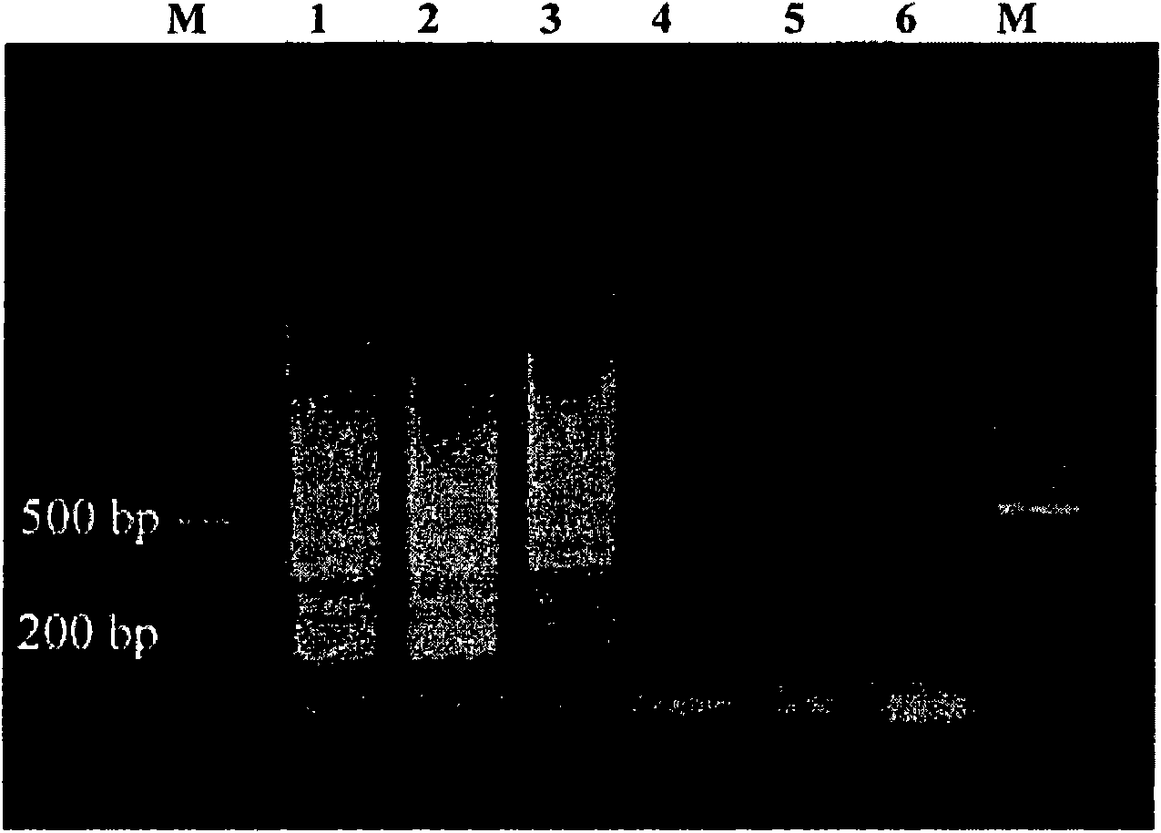 A method of detecting cryptosporidium