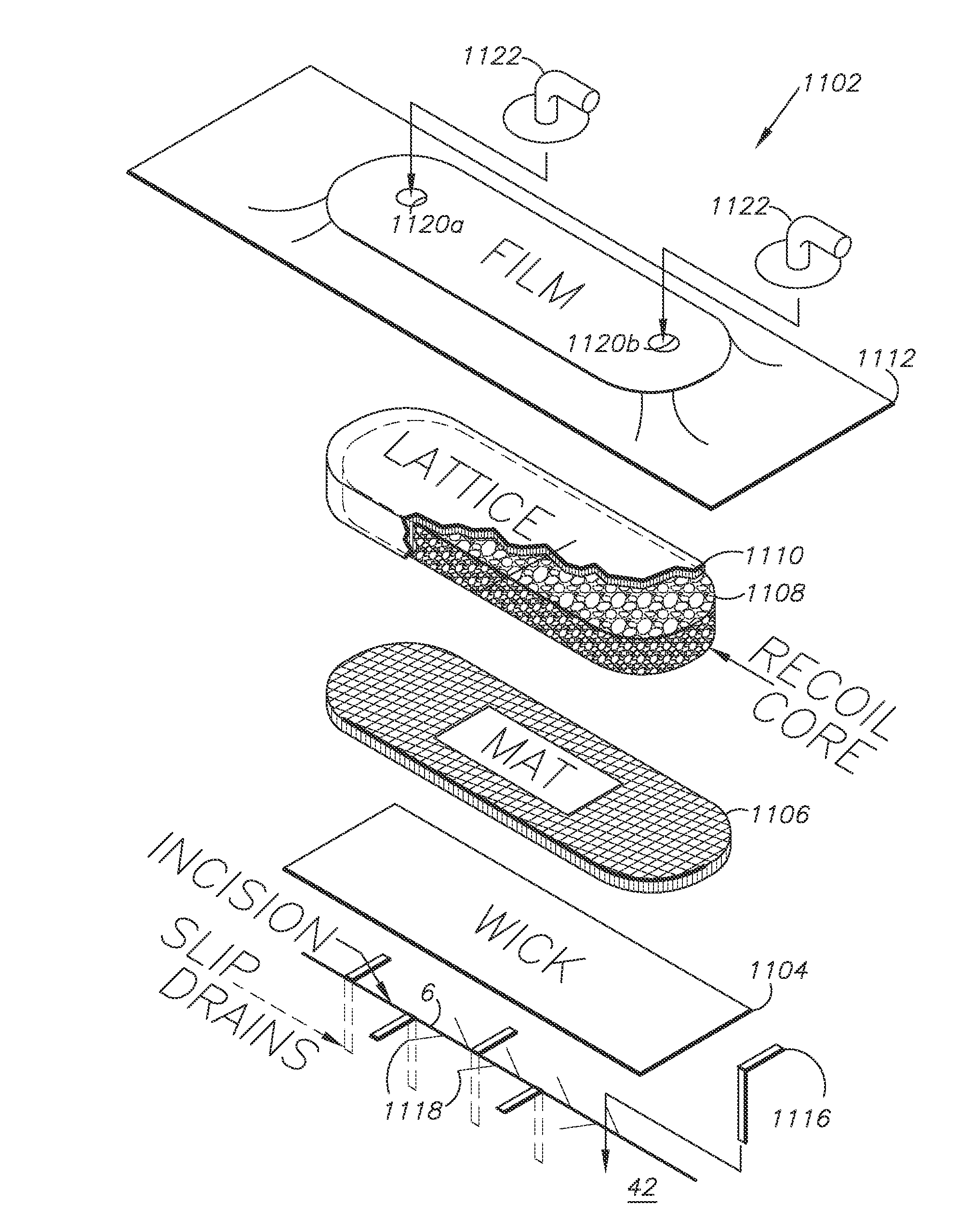 Externally-applied patient interface system and method